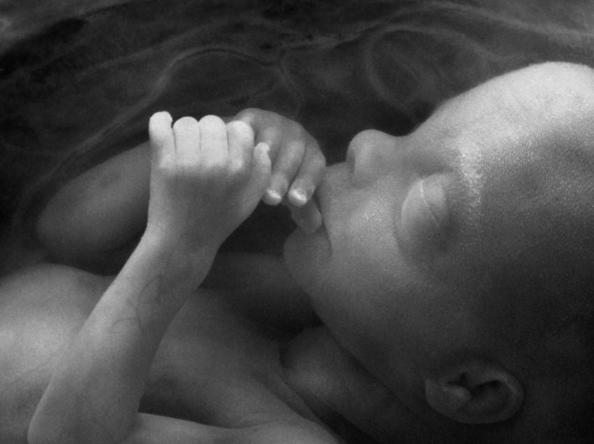 Massachusetts Just Legalized Abortion Up to Birth